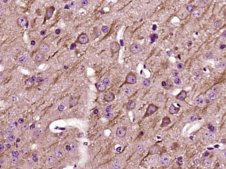 Paraformaldehyde-fixed, paraffin embedded Mouse brain; Antigen retrieval by boiling in sodium citrate buffer (pH6.0) for 15min; Block endogenous peroxidase by 3% hydrogen peroxide for 20 minutes; Blocking buffer (normal goat serum) at 37°C for 30min; Antibody incubation with UCP-2 Polyclonal Antibody, Unconjugated (bs-20750R) at 1:400 overnight at 4°C, DAB staining.