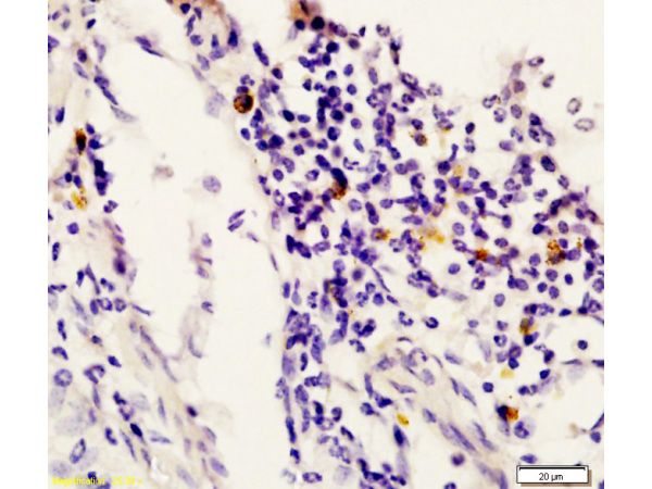 Formalin-fixed and paraffin embedded rat uterus labeled with Anti-STAT6 Polyclonal Antibody, Unconjugated (bs-1143R) at 1:200 followed by conjugation to the secondary antibody and DAB staining.