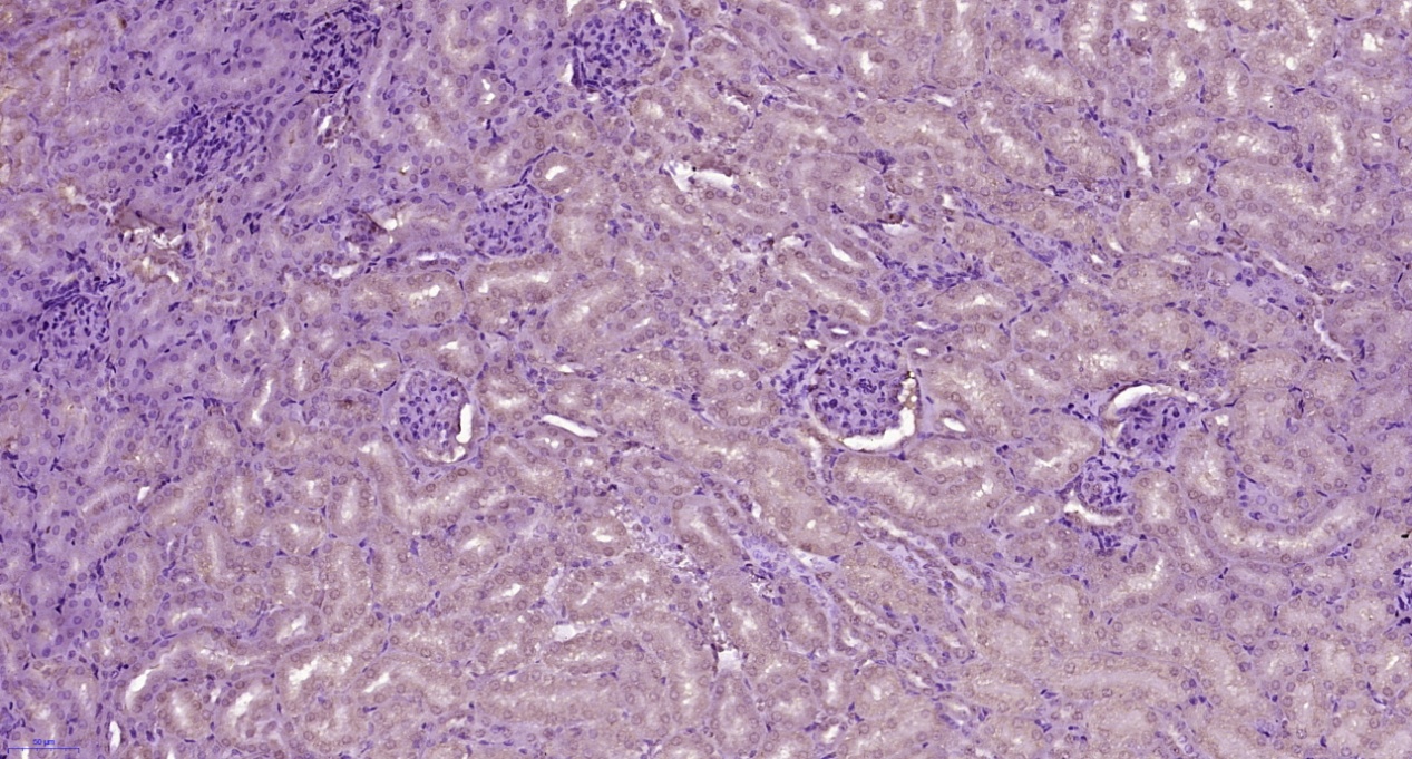 Paraformaldehyde-fixed, paraffin embedded Mouse kidney; Antigen retrieval by boiling in sodium citrate buffer (pH6.0) for 15min; Block endogenous peroxidase by 3% hydrogen peroxide for 20 minutes; Blocking buffer (normal goat serum) at 37°C for 30min; Antibody incubation with Complement C3d fragment Polyclonal Antibody, Unconjugated (bs-4877R) at 1:100 overnight at 4°C, followed by secondary and DAB staining.