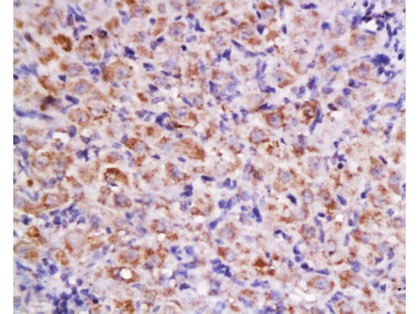 Formalin-fixed and paraffin embedded rat ovary labeled with Anti-Cyclin D2 Polyclonal Antibody, Unconjugated (bs-1148R) at 1:200 followed by conjugation to the secondary antibody and DAB staining.
