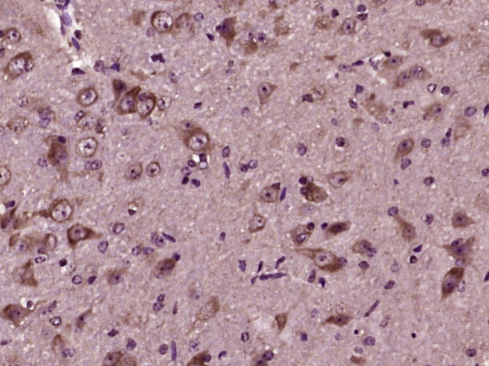 Paraformaldehyde-fixed, paraffin embedded Mouse brain; Antigen retrieval by boiling in sodium citrate buffer (pH6.0) for 15min; Block endogenous peroxidase by 3% hydrogen peroxide for 20 minutes; Blocking buffer (normal goat serum) at 37°C for 30min; Antibody incubation with Asparagine synthetase Polyclonal Antibody, Unconjugated (bs-23431R) at 1:400 overnight at 4°C, DAB staining.