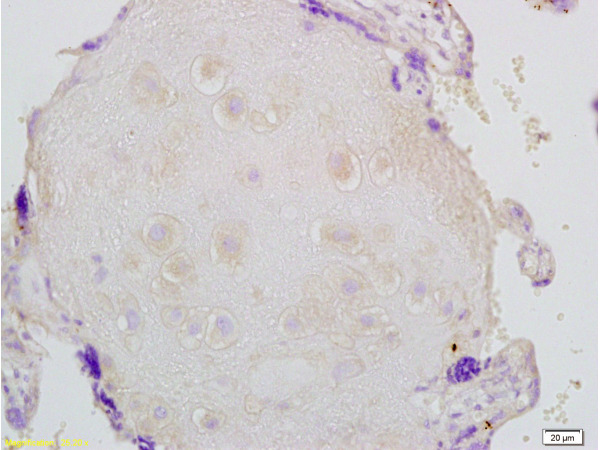 Formalin-fixed and paraffin embedded human placenta labeled with Anti-FBN1/fibrillin 1 Polyclonal Antibody, Unconjugated (bs-1157R) at 1:200 followed by conjugation to the secondary antibody and DAB staining.