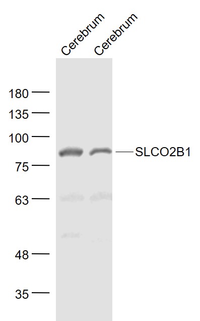 Lane 1:Mouse cerebrum lysates; Lane 2:Rat cerebrum lysates probed with SLCO2B1 Polyclonal Antibody, Unconjugated (bs-3913R) at 1:1000 dilution and 4˚C overnight incubation. Followed by conjugated secondary antibody incubation at 1:20000 for 60 min at 37˚C.