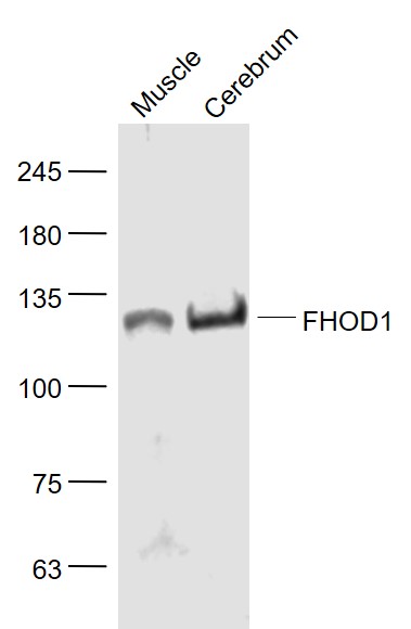 Lane 1:Mouse muscle lysates; Lane 2:Rat Cerebrum lysates probed with FHOD1 Polyclonal Antibody, Unconjugated (bs-13158R) at 1:1000 dilution and 4˚C overnight incubation. Followed by conjugated secondary antibody incubation at 1:20000 for 60 min at 37˚C.