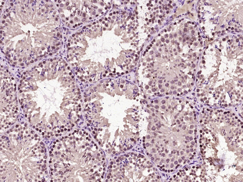 Paraformaldehyde-fixed, paraffin embedded Mouse testis; Antigen retrieval by boiling in sodium citrate buffer (pH6.0) for 15min; Block endogenous peroxidase by 3% hydrogen peroxide for 20 minutes; Blocking buffer (normal goat serum) at 37°C for 30min; Antibody incubation with Beta catenin Polyclonal Antibody, Unconjugated (bs-23663R) at 1:400 overnight at 4°C, DAB staining. Paraformaldehyde-fixed, paraffin embedded Mouse testis; Antigen retrieval by boiling in sodium citrate buffer (pH6.0) for 15min; Block endogenous peroxidase by 3% hydrogen peroxide for 20 minutes; Blocking buffer (normal goat serum) at 37°C for 30min; Antibody incubation with Beta catenin Polyclonal Antibody, Unconjugated (bs-23663R) at 1:400 overnight at 4°C, DAB staining.