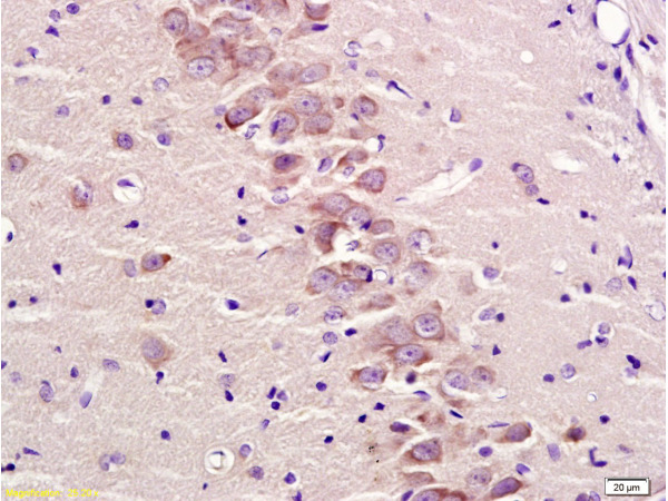 Formalin-fixed and paraffin embedded rat brain tissue labeled with Anti-GRM2\/GLUR2 Polyclonal Antibody, Unconjugated (bs-1161R) at 1:300 followed by conjugation to the secondary antibody and DAB staining\\n