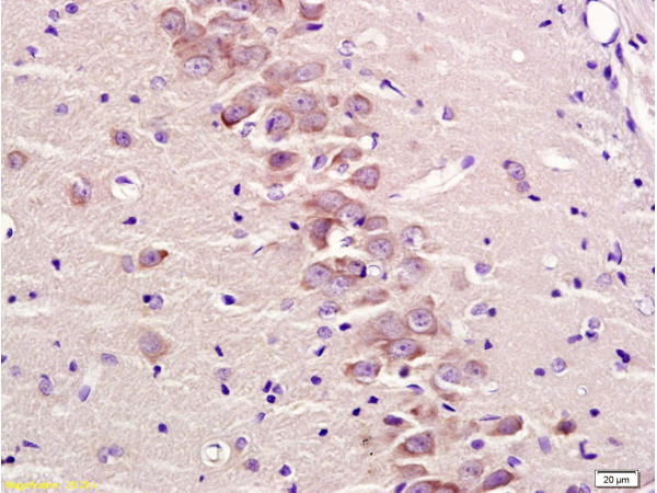 Formalin-fixed and paraffin embedded rat brain tissue labeled with Anti-GRM2/GLUR2 Polyclonal Antibody, Unconjugated (bs-1161R) at 1:300 followed by conjugation to the secondary antibody and DAB staining\n