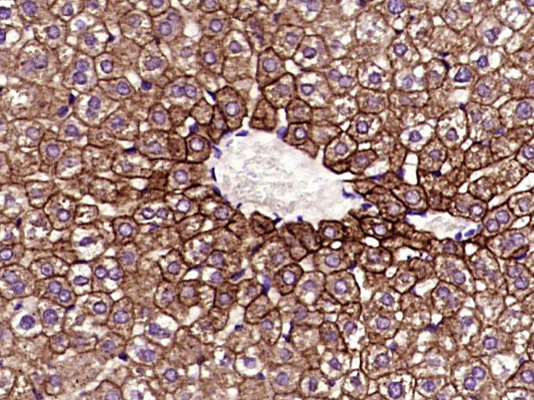 Paraformaldehyde-fixed, paraffin embedded Mouse liver; Antigen retrieval by boiling in sodium citrate buffer (pH6.0) for 15min; Block endogenous peroxidase by 3% hydrogen peroxide for 20 minutes; Blocking buffer (normal goat serum) at 37°C for 30min; Antibody incubation with Cytokeratin 8 Monoclonal Antibody, Unconjugated (bsm-33061M) at 1:400 overnight at 4°C, DAB staining. Paraformaldehyde-fixed, paraffin embedded Mouse liver; Antigen retrieval by boiling in sodium citrate buffer (pH6.0) for 15min; Block endogenous peroxidase by 3% hydrogen peroxide for 20 minutes; Blocking buffer (normal goat serum) at 37°C for 30min; Antibody incubation with Cytokeratin 8 Monoclonal Antibody, Unconjugated (bsm-33061M) at 1:400 overnight at 4°C, DAB staining.