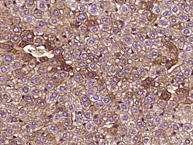 Paraformaldehyde-fixed, paraffin embedded Rat liver; Antigen retrieval by boiling in sodium citrate buffer (pH6.0) for 15min; Block endogenous peroxidase by 3% hydrogen peroxide for 20 minutes; Blocking buffer (normal goat serum) at 37°C for 30min; Antibody incubation with Cytokeratin 8 Monoclonal Antibody, Unconjugated (bsm-33061M) at 1:400 overnight at 4°C, DAB staining.