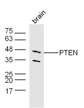 Lane 1:Mouse Cerebrum lysates probed with PTEN Polyclonal Antibody, Unconjugated (bs-0748R) at 1:300 dilution and 4˚C overnight incubation. Followed by conjugated secondary antibody incubation at 1:20000 for 60 min at 37˚C. Lane 1:Mouse Cerebrum lysates probed with PTEN Polyclonal Antibody, Unconjugated (bs-0748R) at 1:300 dilution and 4˚C overnight incubation. Followed by conjugated secondary antibody incubation at 1:20000 for 60 min at 37˚C.