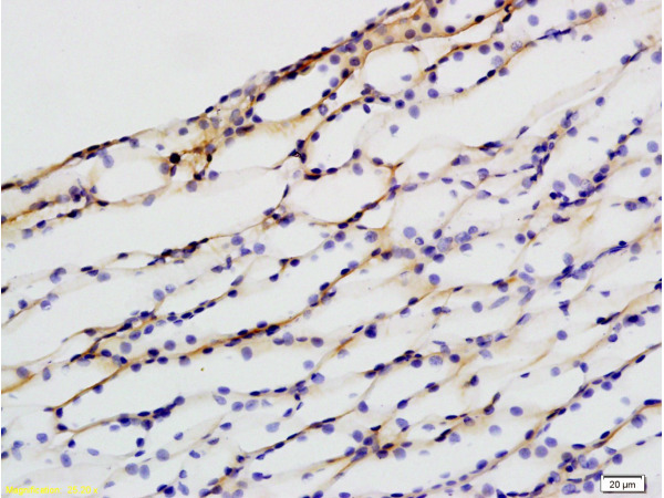 Formalin-fixed and paraffin embedded rat kidney labeled with Anti-beta Defensin 1 Polyclonal Antibody, Unconjugated (bs-1163R) at 1:200 followed by conjugation to the secondary antibody and DAB staining.