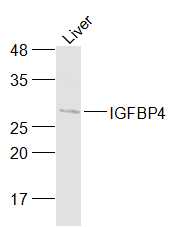 Mouse Liver lysates probed with IGFBP4 Polyclonal Antibody, Unconjugated (bs-10585R) at 1:1000 dilution and 4˚C overnight incubation. Followed by conjugated secondary antibody incubation at 1:20000 for 60 min at 37˚C.
