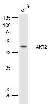 Mouse lung lysates probed with AKT2 Polyclonal Antibody, Unconjugated (bs-10724R) at 1:500 dilution and 4˚C overnight incubation. Followed by conjugated secondary antibody incubation at 1:20000 for 60 min at 37˚C.