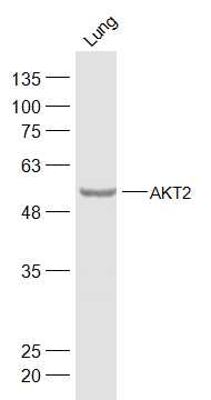 Rat lung lysates probed with AKT2 Polyclonal Antibody, Unconjugated (bs-10724R) at 1:500 dilution and 4˚C overnight incubation. Followed by conjugated secondary antibody incubation at 1:20000 for 60 min at 37˚C.