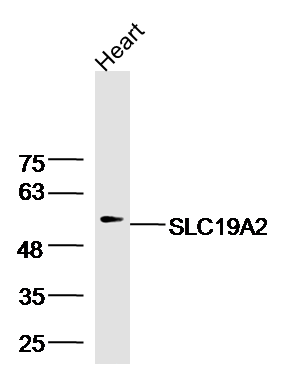 Mouse Heart lysates probed with SLC19A2 Polyclonal Antibody, Unconjugated (bs-10738R) at 1:300 dilution and 4˚C overnight incubation. Followed by conjugated secondary antibody incubation at 1:20000 for 60 min at 37˚C.