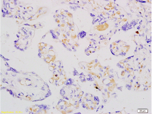 Formalin-fixed and paraffin embedded human placenta labeled with Anti-ADFP Polyclonal Antibody, Unconjugated (bs-1164R) at 1:200 followed by conjugation to the secondary antibody and DAB staining.