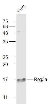 FHC cell lysates probed with Reg3a Polyclonal Antibody, Unconjugated (bs-10913R) at 1:500 dilution and 4˚C overnight incubation. Followed by conjugated secondary antibody incubation at 1:20000 for 60 min at 37˚C.