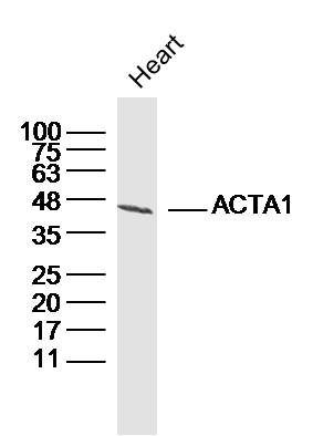 Mouse heart lysates probed with Actin/ACTA1 Polyclonal Antibody, Unconjugated (bs-10966R) at 1:300 dilution and 4˚C overnight incubation. Followed by conjugated secondary antibody incubation at 1:20000 for 60 min at 37˚C.