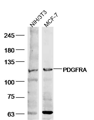 Lane 1: NIH/3T3 cell lysates; Lane 2: MCF-7 cell lysates probed with PDGFRA Polyclonal Antibody, Unconjugated (bs-10989R) at 1:500 dilution and 4˚C overnight incubation. Followed by conjugated secondary antibody incubation at 1:20000 for 60 min at 37˚C.