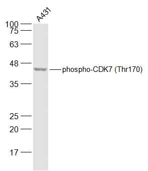 A431 cell lysates probed with phospho-CDK7 (Thr170) Polyclonal Antibody, Unconjugated (bs-10997R) at 1:500 dilution and 4˚C overnight incubation. Followed by conjugated secondary antibody incubation at 1:20000 for 60 min at 37˚C.