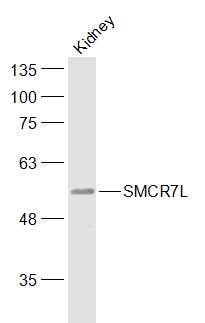 Mouse kidney lysates probed with SMCR7L Polyclonal Antibody, Unconjugated (bs-12634R) at 1:1000 dilution and 4˚C overnight incubation. Followed by conjugated secondary antibody incubation at 1:20000 for 60 min at 37˚C.