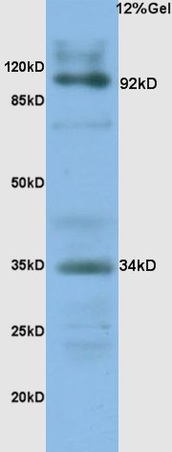 L1 human colon carcinoma lysates probed with Anti- CD138\/Syndecan-1 Polyclonal Antibody, Unconjugated (bs-1309R) at 1:200 overnight at 4˚C. Followed by conjugation to secondary antibody (bs-0295G-HRP) at 1:3000 for 90 min at 37˚C. Predicted band 34kD.Observed band 34D, 92kD