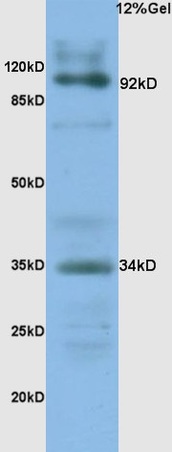 L1 human colon carcinoma lysates probed with Anti- CD138/Syndecan-1 Polyclonal Antibody, Unconjugated (bs-1309R) at 1:200 overnight at 4˚C. Followed by conjugation to secondary antibody (bs-0295G-HRP) at 1:3000 for 90 min at 37˚C. Predicted band 34kD.Observed band 34D, 92kD L1 human colon carcinoma lysates probed with Anti- CD138/Syndecan-1 Polyclonal Antibody, Unconjugated (bs-1309R) at 1:200 overnight at 4˚C. Followed by conjugation to secondary antibody (bs-0295G-HRP) at 1:3000 for 90 min at 37˚C. Predicted band 34kD.Observed band 34D, 92kD