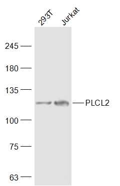 Lane 1: 293T cell lysates; Lane 2: Jurkat cell lysates probed with PLCL2 Polyclonal Antibody, Unconjugated (bs-12715R) at 1:500 dilution and 4˚C overnight incubation. Followed by conjugated secondary antibody incubation at 1:20000 for 60 min at 37˚C.