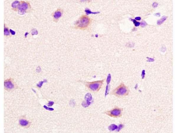 Formalin-fixed and paraffin embedded rat brain tissue labeled with Anti-Beta catenin Polyclonal Antibody, Unconjugated(bs-1165R) at 1:200 followed by conjugation to the secondary antibody,