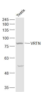 Mouse testis lysates probed with VRTN Polyclonal Antibody, Unconjugated (bs-12781R) at 1:500 dilution and 4˚C overnight incubation. Followed by conjugated secondary antibody incubation at 1:20000 for 60 min at 37˚C.