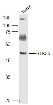 Rat testis lysates probed with STK35 Polyclonal Antibody, Unconjugated (bs-12834R) at 1:300 dilution and 4˚C overnight incubation. Followed by conjugated secondary antibody incubation at 1:20000 for 60 min at 37˚C.
