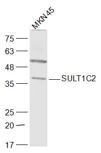 MKN45 cell lysates probed with SULT1C2 Polyclonal Antibody, Unconjugated (bs-12840R) at 1:1000 dilution and 4˚C overnight incubation. Followed by conjugated secondary antibody incubation at 1:20000 for 60 min at 37˚C.