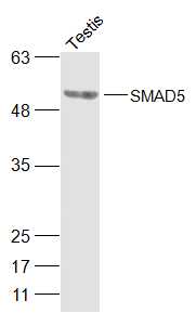 Mouse testis lysates probed with SMAD5 Polyclonal Antibody, Unconjugated (bs-13890R) at 1:500 dilution and 4˚C overnight incubation. Followed by conjugated secondary antibody incubation at 1:20000 for 60 min at 37˚C.
