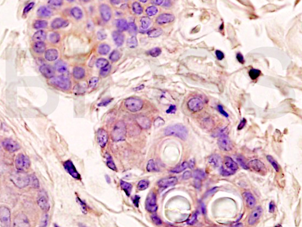 Formalin-fixed and paraffin embedded rat skin labeled with Anti-β-catenin/Catenin β Polyclonal Antibody, Unconjugated (bs-1165R) at 1:200 followed by conjugation to the secondary antibody and DAB staining.