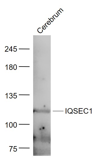 Mouse Cerebrum lysates probed with GEP100/IQSEC1 Polyclonal Antibody, Unconjugated (bs-13960R) at 1:300 dilution and 4˚C overnight incubation. Followed by conjugated secondary antibody incubation at 1:20000 for 60 min at 37˚C.