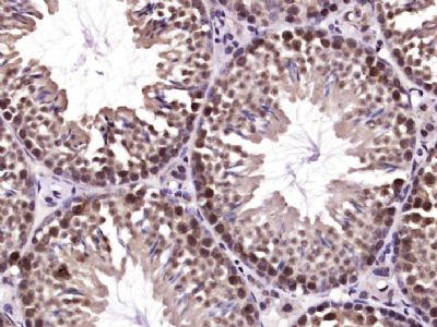 Paraformaldehyde-fixed, paraffin embedded Mouse testis; Antigen retrieval by boiling in sodium citrate buffer (pH6.0) for 15min; Block endogenous peroxidase by 3% hydrogen peroxide for 20 minutes; Blocking buffer (normal goat serum) at 37°C for 30min; Antibody incubation with SHARPIN Polyclonal Antibody, Unconjugated (bs-9581R) at 1:400 overnight at 4°C, followed by DAB staining.