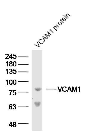 Lane 1: Human VCAM1 protein; Probed with Rabbit Anti-VCAM1 Polyclonal Antibody, Unconjugated (bs-0396R) at 1:300 overnight at 4˚C. Followed by a conjugated secondary antibody at 1:20000 for 90 min at 37˚C.