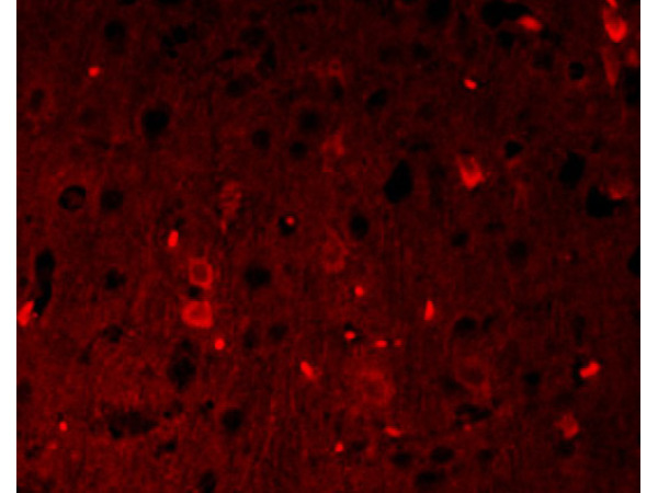 Formalin-fixed and paraffin-embedded rat brain labeled with Anti-\u03b2-catenin\/Catenin \u03b2 Polyclonal Antibody, Unconjugated(bs-1165R) 1:200, overnight at 4\u00b0C, The secondary antibody was Goat Anti-Rabbit IgG, PE conjugated(bs-0295G-PE)used at 1:200 dilution for 40 minutes at 37\u00b0C.