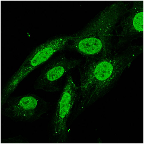 U-2OS cells were stained with VPS13D Polyclonal Antibody, Unconjugated(bs-12766R) at 1:100 in PBS and incubated for two hours at 37°C followed by Goat Anti-Rabbit IgG (H+L) FITC conjugated secondary antibody. DAPI staining of the nucleus was done and then detected.