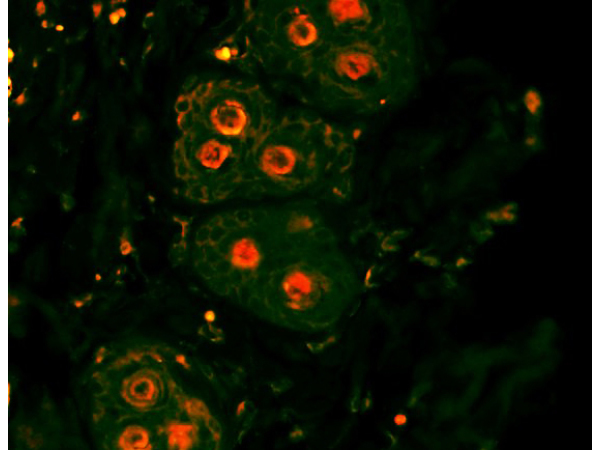 Formalin-fixed and paraffin-embedded rat skin labeled with Anti-β-catenin/Catenin β Polyclonal Antibody, Unconjugated(bs-1165R) 1:200, overnight at 4°C, The secondary antibody was Goat Anti-Rabbit IgG, PE conjugated(bs-0295G-PE)used at 1:200 dilution for 40 minutes at 37°C.