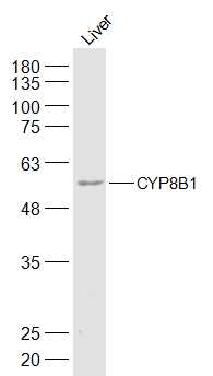 Mouse Liver lysates probed with CYP8B1 Polyclonal Antibody, Unconjugated (bs-14165R) at 1:300 dilution and 4˚C overnight incubation. Followed by conjugated secondary antibody incubation at 1:20000 for 60 min at 37˚C.