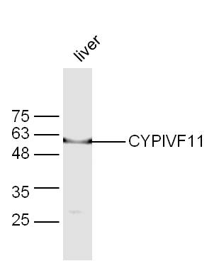 Mouse Liver lysates probed with CYPIVF11 Polyclonal Antibody, Unconjugated (bs-14166R) at 1:300 dilution and 4˚C overnight incubation. Followed by conjugated secondary antibody incubation at 1:20000 for 60 min at 37˚C.