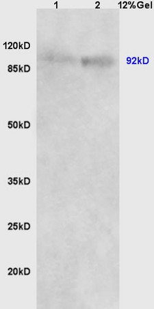 Lane 1: human colon carcinoma lysates Lane 2: mouse embryo lysates probed with Anti Beta-catenin/Catenin Beta Polyclonal Antibody, Unconjugated (bs-1165R) at 1:200 in 4C. Followed by conjugation to secondary antibody (bs-0295G-HRP) at 1:3000 90min in 37C. Predicted band 92kD. Observed band size: 92kD