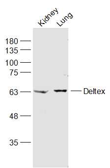 Lane 1: Mouse kidney lysates; Lane 2: Mouse lung lysates probed with Deltex Polyclonal Antibody, Unconjugated (bs-14265R) at 1:1000 dilution and 4˚C overnight incubation. Followed by conjugated secondary antibody incubation at 1:20000 for 60 min at 37˚C.