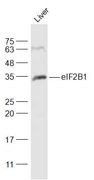 Mouse Liver lysates probed with eIF2B1 Polyclonal Antibody, Unconjugated (bs-14535R) at 1:500 dilution and 4˚C overnight incubation. Followed by conjugated secondary antibody incubation at 1:20000 for 60 min at 37˚C.