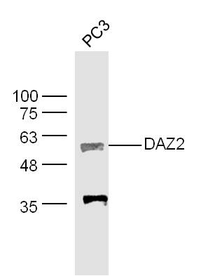 PC-3 cell lysates probed with DAZ2 Polyclonal Antibody, Unconjugated (bs-14999R) at 1:300 dilution and 4˚C overnight incubation. Followed by conjugated secondary antibody incubation at 1:20000 for 60 min at 37˚C.