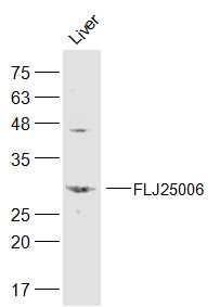 Mouse Liver lysates probed with FLJ25006 Polyclonal Antibody, Unconjugated (bs-16116R) at 1:300 dilution and 4˚C overnight incubation. Followed by conjugated secondary antibody incubation at 1:20000 for 60 min at 37˚C.