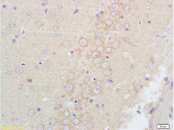Formalin-fixed and paraffin embedded rat brain tissue labeled with Anti-GABRA1 Polyclonal Antibody, Unconjugated(bs-1232R) at 1:200 followed by conjugation to the secondary antibody and DAB staining