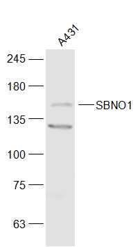 A431 cell lysates probed with SBNO1 Polyclonal Antibody, Unconjugated (bs-17251R) at 1:300 dilution and 4˚C overnight incubation. Followed by conjugated secondary antibody incubation at 1:20000 for 60 min at 37˚C.