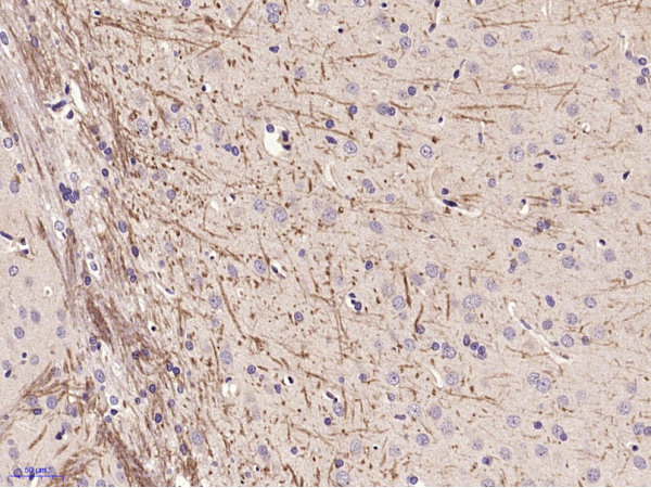 Paraformaldehyde-fixed, paraffin embedded Rat brain; Antigen retrieval by boiling in sodium citrate buffer (pH6.0) for 15min; Block endogenous peroxidase by 3% hydrogen peroxide for 20 minutes; Blocking buffer (normal goat serum) at 37°C for 30min; Antibody incubation with ABCG4 Polyclonal Antibody, Unconjugated (bs-1727R) at 1:400 overnight at 4°C, DAB staining.